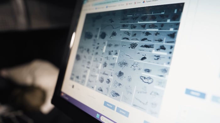 Des images de phytoplanton apparaissent sur l'Acran d'en ocoratiur.